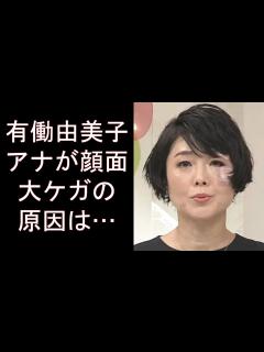 [画像][x]有働由美子アナが顔面大ケガの原因は…news zero降板発表後に衝撃姿、飲酒トラブルや殴られた疑惑も。画像あり - YouTube 余白なし