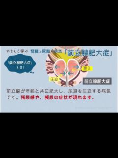 [画像][x]やさしく学ぶ－泌尿器の病気 前立腺肥大症 - YouTube 余白なし