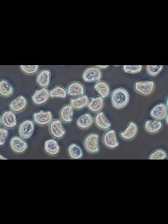 [画像][x]スギ花粉の顕微鏡観察 - YouTube 余白なし