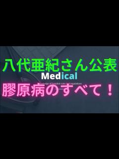 [画像][x]【八代亜紀さん公表】膠原病のすべて！全身性エリテマトーデス、強皮症、初期症状、皮膚筋炎。 - YouTube 余白なし