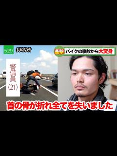 [画像][x]【潰れた顔面】事故で顔面が潰れ歯が無くなった死にかけ男を大変身‼︎ - YouTube 余白なし