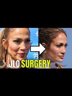 [画像][x]Jennifer Lopez: Plastic Surgery (2020) - YouTube 余白なし