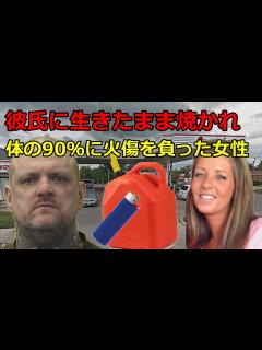 [画像][x]彼氏に生きたまま焼かれ、 壮絶な人生を生き抜いた女性 - YouTube 余白なし