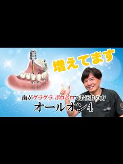 [画像][x]ここ数年増えてきたオールオン4について - YouTube 余白なし