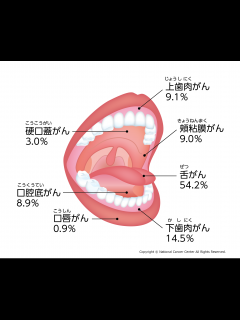 [画像][x]森永卓郎さんが、がん公表。森永さんの完治を祈って元がん患者としてもメッセージ。2023/12/28 - YouTube 余白なし