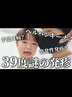 [画像][x]ヘルパンギーナ？手足口病？1歳児が39度高熱からの謎の発疹👶💦【共働き夫婦の育児】 - YouTube 余白なし