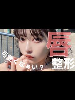 [画像][x]唇の整形したらめちゃくちゃ可愛くなった！ - YouTube 余白なし