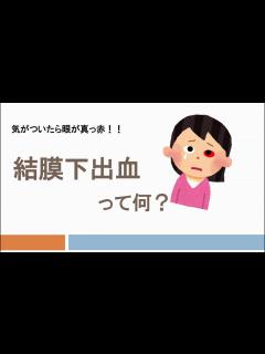 [画像][x]結膜下出血ってなあに - YouTube 余白なし