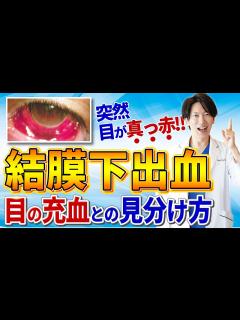 [画像][x]結膜下出血の原因と対処法｜自然に治る病気？それとも危険なサイン？最新の眼科医が詳しく解説 - YouTube 余白なし