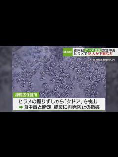 [画像][x]都内初 寄生虫“クドア”が原因の食中毒/First case of food poisoning caused by Kudoa ... 余白なし