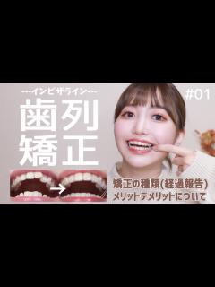 [画像][x]痛い？大変？歯列矯正を始めて感じたメリットデメリットを話します。【#1/インビザライン 余白なし