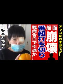 [画像][x]”和田アキ子”が手術失敗で顔面崩壊・歩行困難と言われる真相がやばい！？難病告白で「アッコにおまかせ！」が打ち切りになる…！？余命宣告さ ... 余白なし
