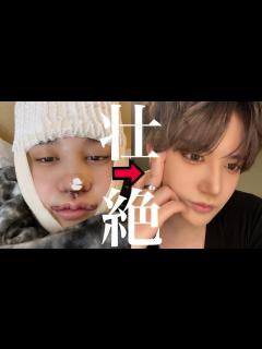 [画像][x]整形総金額が1000万円を超えました😨 - YouTube 余白なし