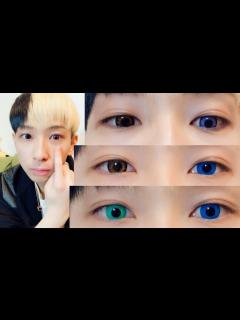 [画像][x]【驚愕の変化】たった10万円で目をいじった結果… - YouTube 余白なし